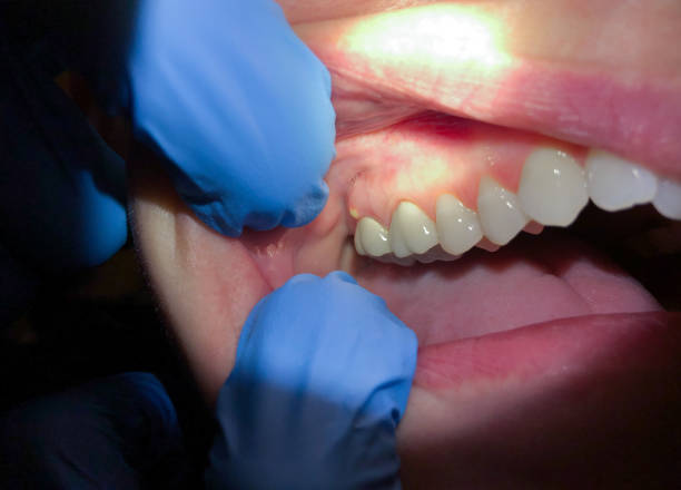 Best Mobile Emergency Dentist in Ninnekah, OK