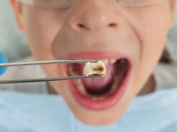 Best Pediatric Emergency Dentist in Ninnekah, OK