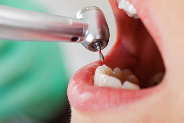 Best Emergency Dental Care for Abscessed Tooth in Ninnekah, OK